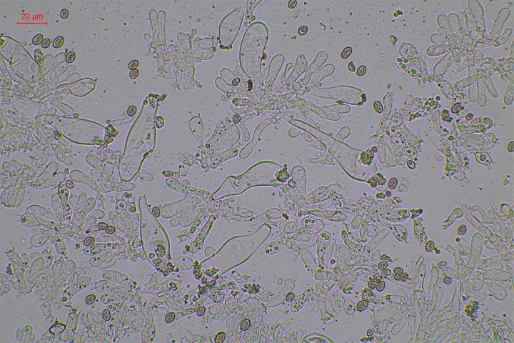 cheilocystides, paracystides et basides