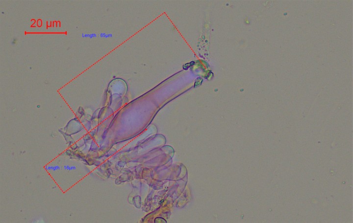 caulocystides et paracystides