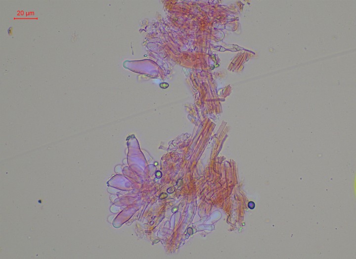 caulocystides et paracystides