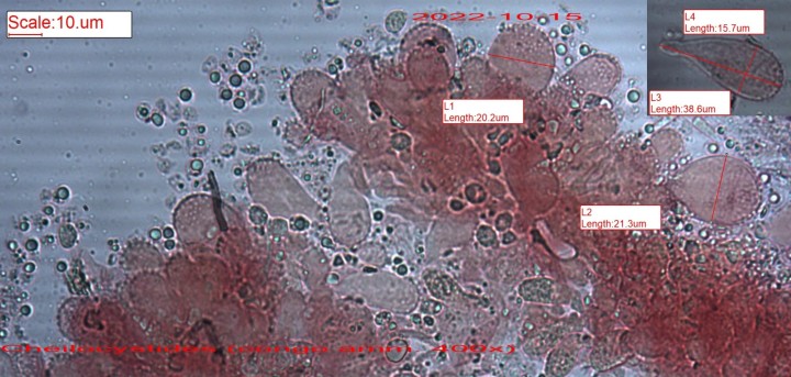 Cystides clavées à excroissances apicales verruqueuses