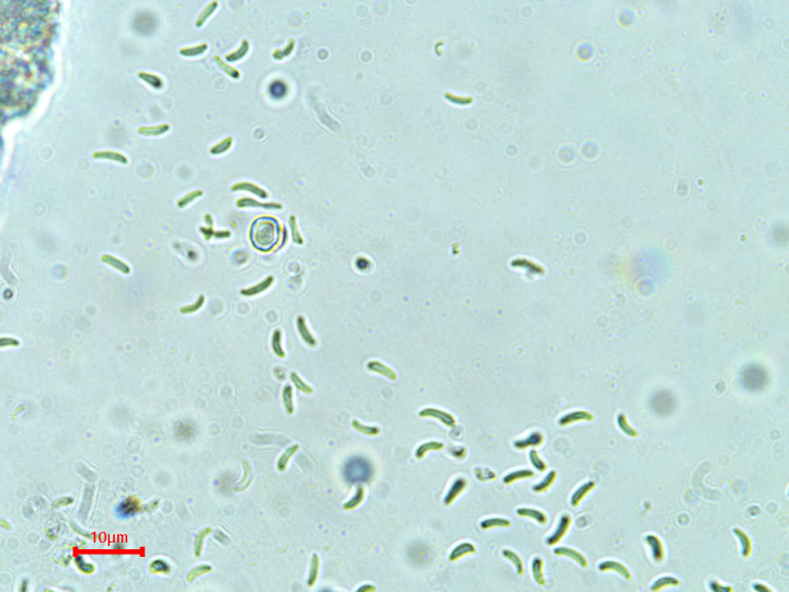 pycnidiospores