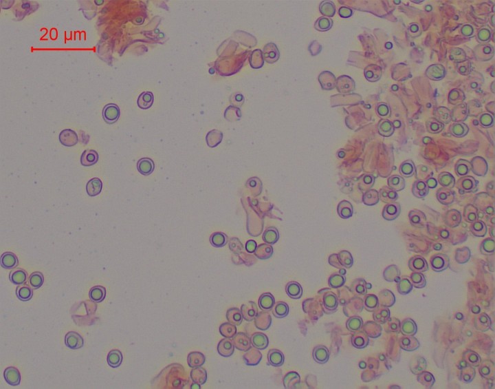 spores-002.jpg