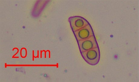 basides spores-012.jpg