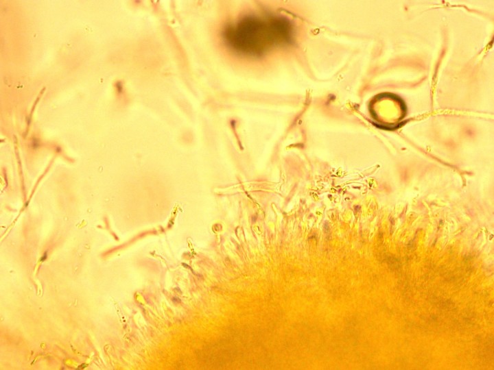 asco40X#2.jpg