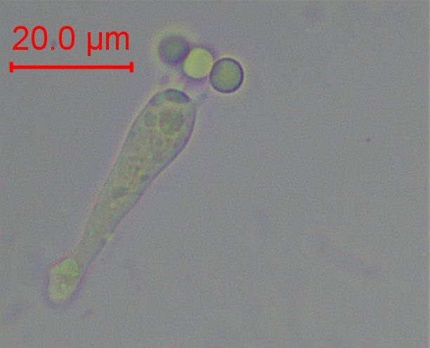 baside clavée bouclée, x4 spores