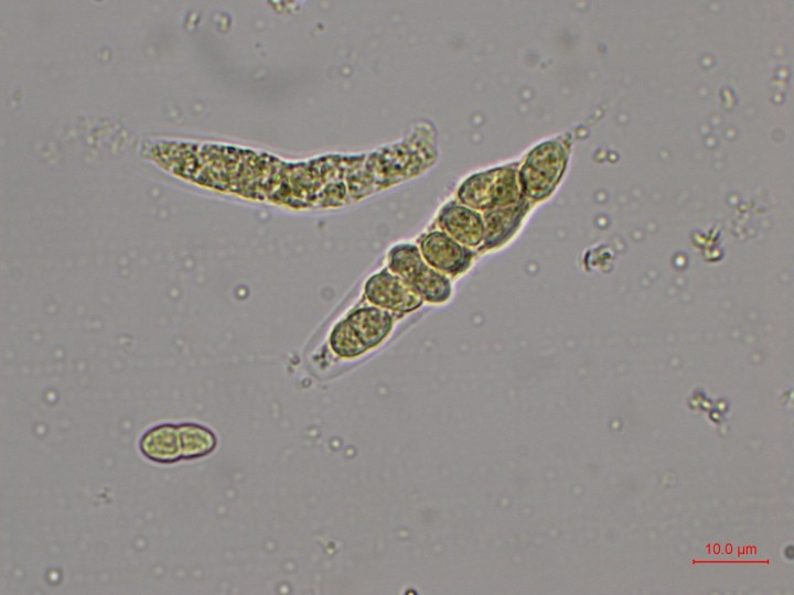 Ascospores et spores
