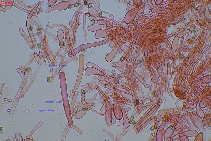 Caulocystides haut du stipe uniquement