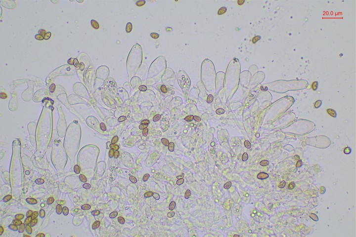 Cheiloscystides dans NH4OH
