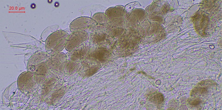 Pileipellis constitué de cellules pigmentées sphéropédonculées. Boucles absentes