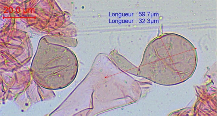Cellules sphéropédonculées