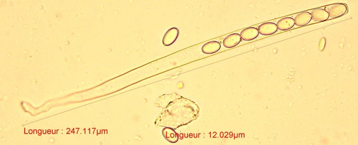 asquePézize.jpg