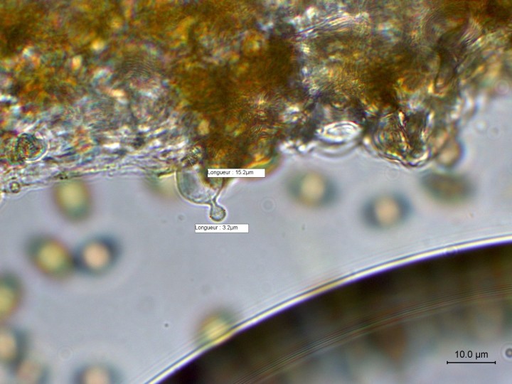 cheilocystides