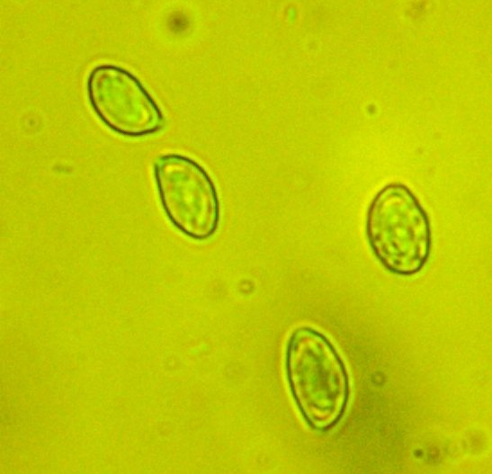 Gymnopilus spectabilis spores 01.jpg