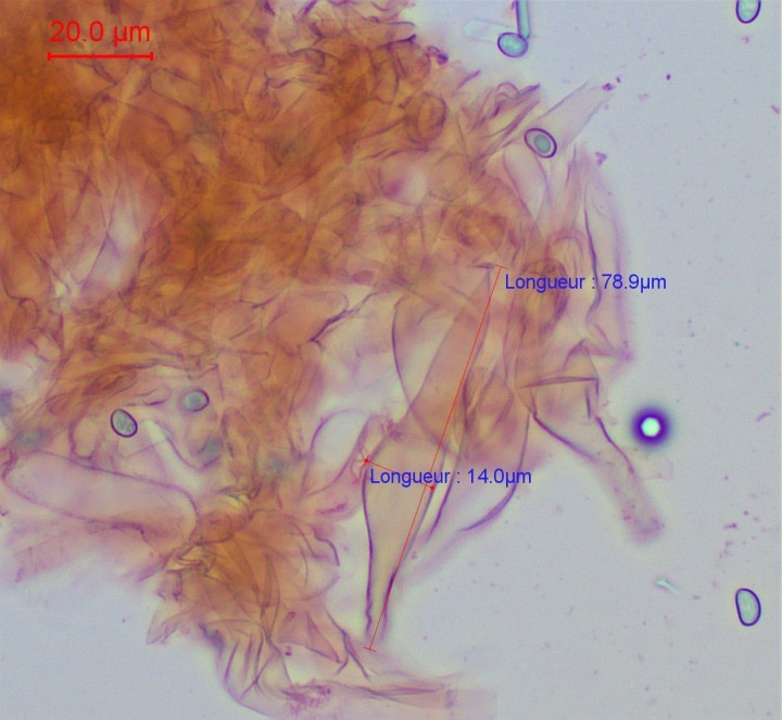piléocystides-002.jpg