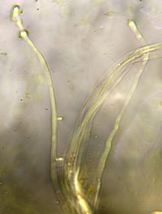 paraphyses.jpg