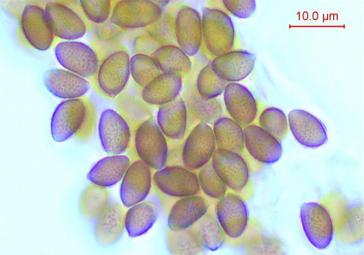 Spores dans le Melzer moyennement dextrinoïdes et finement verruqueuses. Le périspore se décolle ici ou là