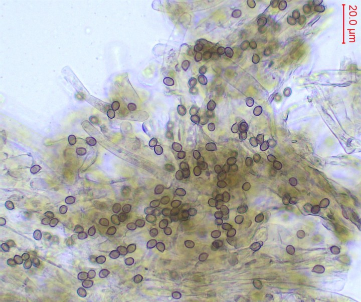 spores sur l'anneau : N= 40 ; (4,7)5-5,5-6(6,15) x (3,8)3,85-4,35-4,55(4,6) ; Qm= 1,31