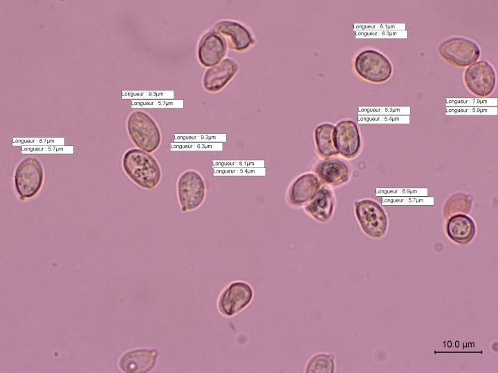 spores  x1000