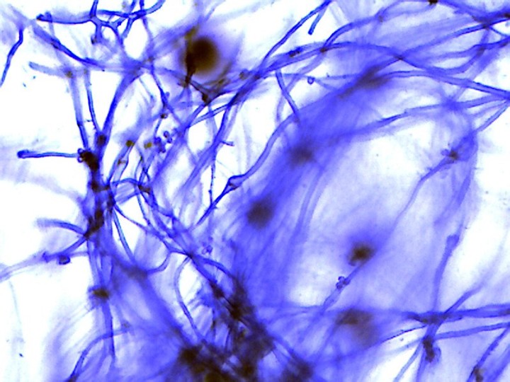 Hyphes du capillitium