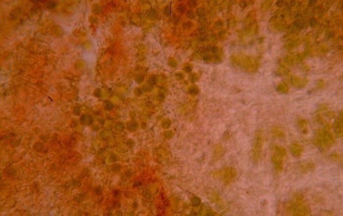micro2 X paretina.JPG