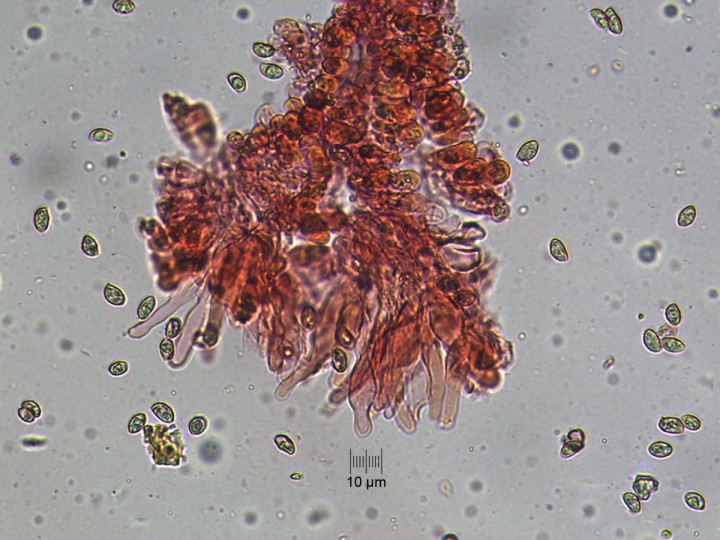 spores_cheilos_x400.jpg