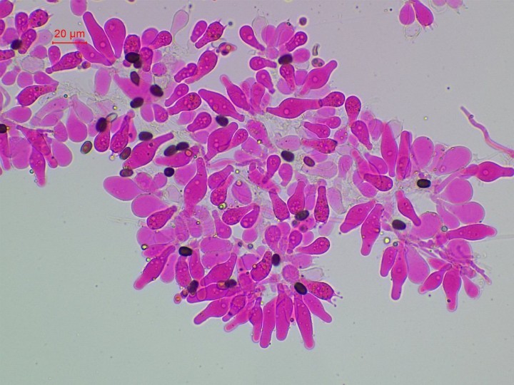 Cheilocystides lagéniformes mêlées à des paracystides clavées, basides et basidioles