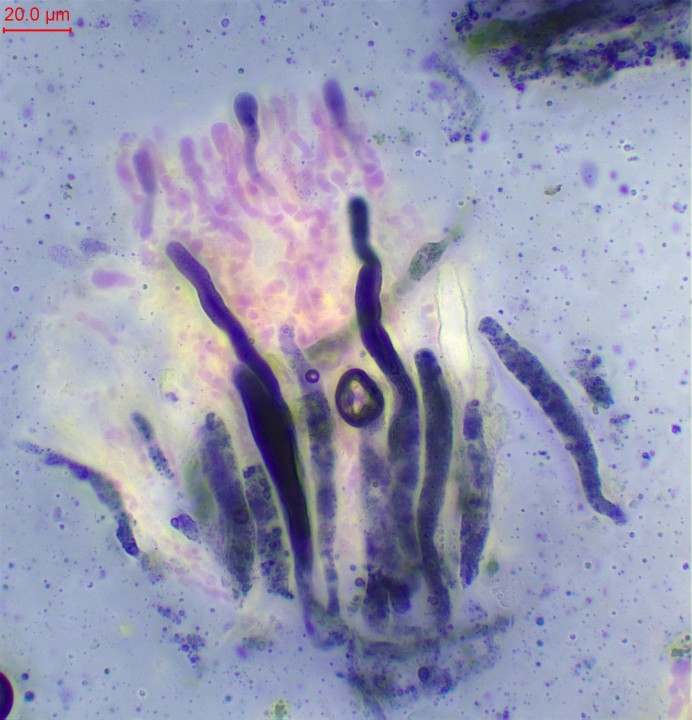 Gloéocystides dans la Sulfovanilline