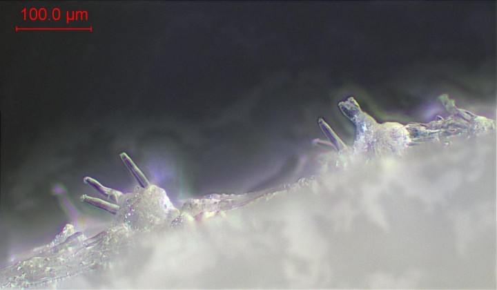 caulocystides haut du stipe