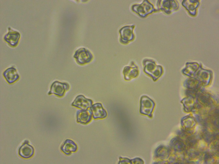 Entoloma spores-0001.jpg