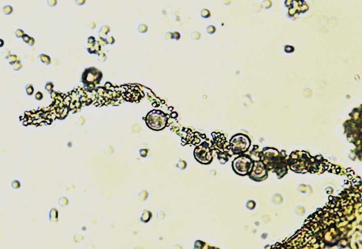 Capillitium, noeuds calcaires & spores.jpg