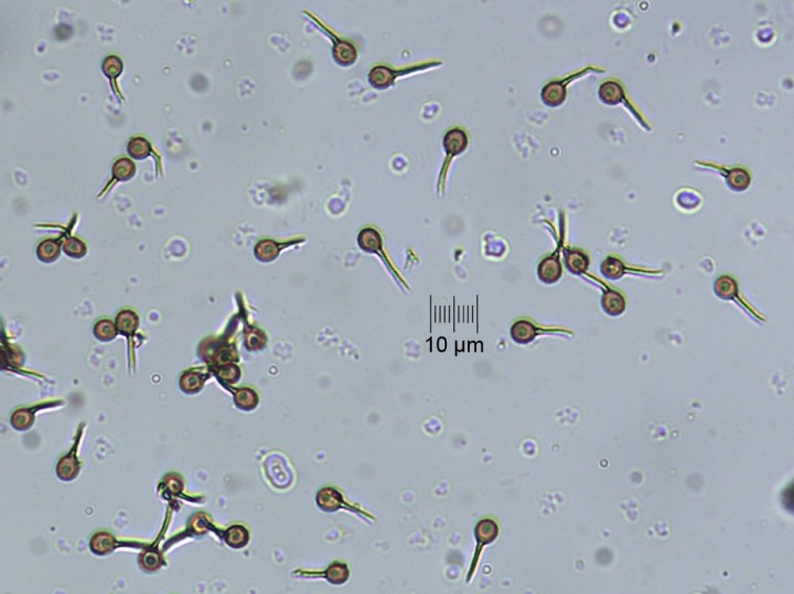 spores_x400_01.jpg