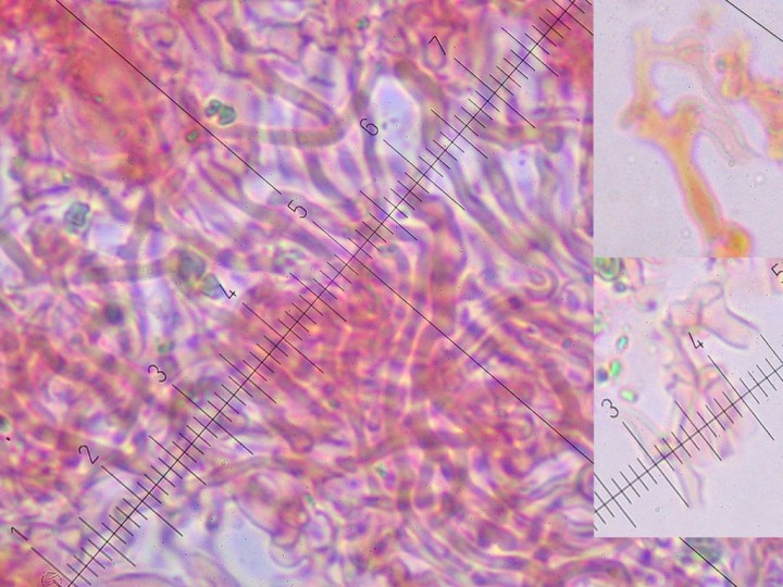 Hyphes squelettiques non septées à paroi épaissie et Hyphes génératrices bouclées à gauche.