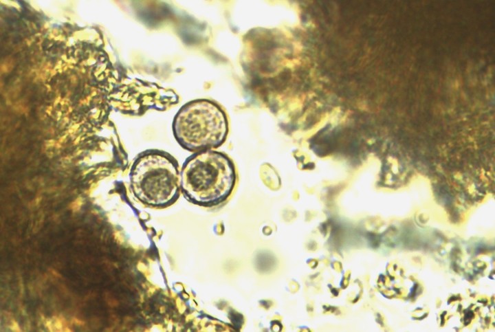 SPORES 8 µ.jpg